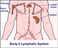 Hodgkins Lymphoma