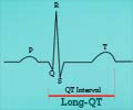 Long QT Syndrome