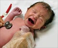 Neonatal Abstinence Syndrome