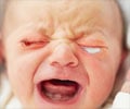 Neonatal Conjunctivitis