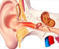 Otitis Externa / Swimmer's Ear Infection