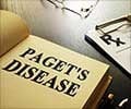 Paget's Disease And Other Jaw Bone Diseases