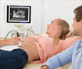 Prenatal Screening Test