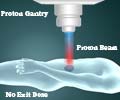 Proton Beam Therapy for Cancer Treatment