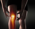 Runners Knee