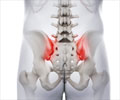 Sacroiliac Joint Dysfunction