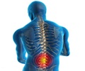Spondylosis