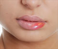 Swollen Lips Symptom Evaluation