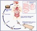 Tapeworm Infections