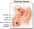 Testicular Cancer - Support Groups