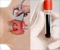 Screening Tests for Thyroid Dysfunction Screening Tests for Thyroid Dysfunction