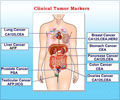 Tumor Markers For Cancer Diagnosis and Prognosis