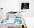Ultrasound During Pregnancy