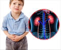 Urology Paediatric Emergencies