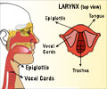 Voice Disorders