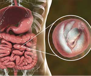 what is a parasite infection in humans