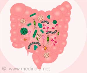 Small Intestine Bacterial Overgrowth (SIBO)
