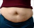 Test Your Knowledge on Abdominal / Belly Fat