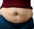 Quiz on Abdominal / Belly Fat