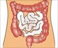 Quiz on Colon
