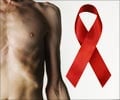 Quiz on HIV Symptoms