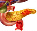 pancreatic cancer symptoms early