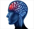 Test your Knowledge on Brain Injury