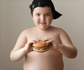 Test Your Knowledge on Childhood Obesity