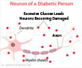 Test Your Knowledge on Diabetic Nerve Pain | Diabetic Neuropathy