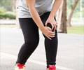 Test Your Knowledge on Knee Pain Test Your Knowledge on Knee Pain