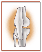 Arthiritis: Brightly-coloured fruit and vegetables offer protection