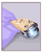 Children With Epilepsy Can Be Treated With Nerve Stimulation