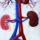 Intensive Care Patients More At Risk From Kidney Failure