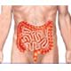 Crohns Disease Could Be Caused By Gaps In The Intestinal Barrier