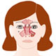 Passive Smoking Could Lead to Chronic Sinus Problems
Passive Smoking Could Lead to Chronic Sinus Problems