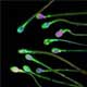 New Target for Male Contraception Identified New Target for Male Contraception Identified