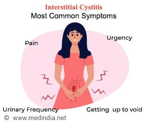 Interstitial Cystitis Symptom Checker & Self-Assessment Calculator