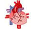  Coronary Artery Bypass Surgery (CABG) - Animation