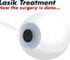 Laser Eye Surgery - Animation