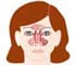 Sinusitis Infection Treatment - Animation