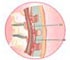  Spinal or Epidural anesthesia - Animation