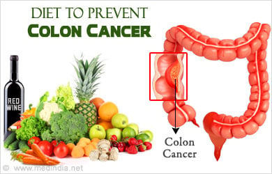 Diet to Prevent Colon Cancer - Health Tips - Glossary