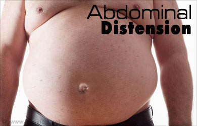 Como reducir la distensión abdominal