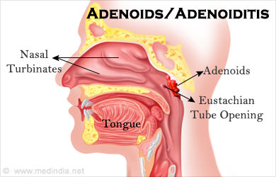 Image result for adenoids