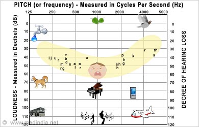 Hearing Banana Chart