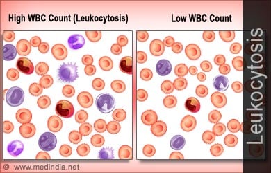 Leukocytosis