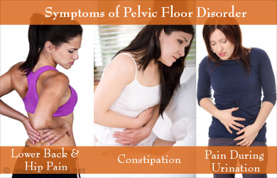 Pelvic Floor Disorders Causes Symptoms Diagnosis Treatment